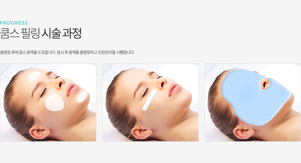 쿰스 필링